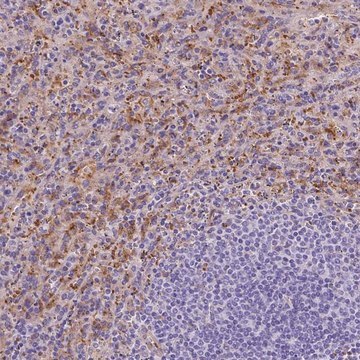 Anti-SLC40A1 antibody produced in rabbit Prestige Antibodies&#174; Powered by Atlas Antibodies, affinity isolated antibody, buffered aqueous glycerol solution