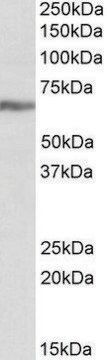 Anti-IGF2BP1 antibody produced in goat affinity isolated antibody, buffered aqueous solution