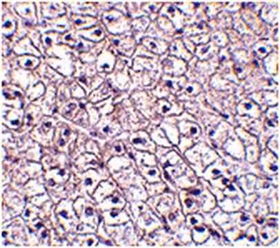 Anti-TSLP receptor Antibody from rabbit, purified by affinity chromatography