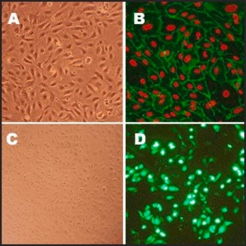 Human Aortic Endothelial Cells: HAOEC, adult