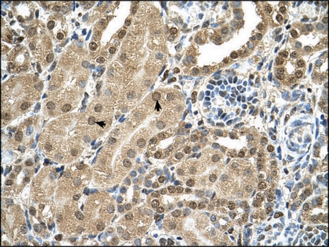 Anti-TBX15 antibody produced in rabbit IgG fraction of antiserum