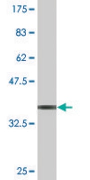 Monoclonal Anti-FZD4 antibody produced in mouse clone 3G7, purified immunoglobulin, buffered aqueous solution