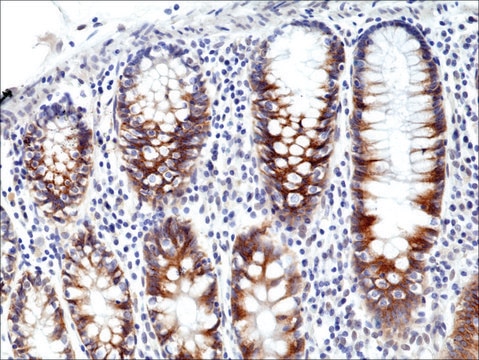 Anti-CD71 antibody, Rabbit monoclonal recombinant, expressed in HEK 293 cells, clone RM384, purified immunoglobulin