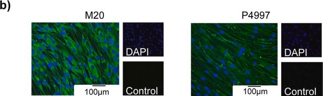 Anti-Potassium Channel KCa3.1 (Intermediate-conductance Ca2+-activated Potassium Channel 4) antibody produced in rabbit affinity isolated antibody, lyophilized powder