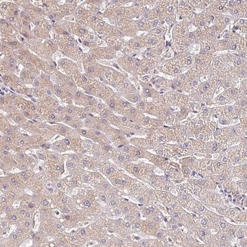 Anti-TTR antibody produced in rabbit Prestige Antibodies&#174; Powered by Atlas Antibodies, affinity isolated antibody, buffered aqueous glycerol solution