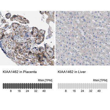 Anti-KIAA1462 antibody produced in rabbit Prestige Antibodies&#174; Powered by Atlas Antibodies, affinity isolated antibody, buffered aqueous glycerol solution