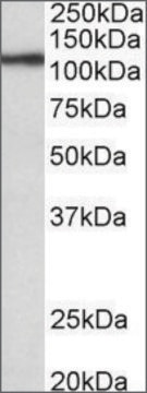 Anti-TPO antibody produced in goat affinity isolated antibody, buffered aqueous solution