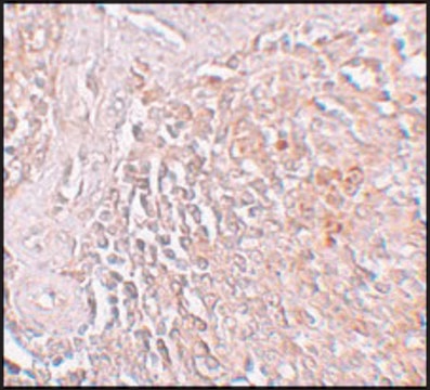 Anti-ZIP8 antibody produced in rabbit affinity isolated antibody, buffered aqueous solution