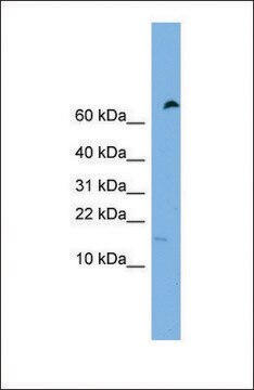 Anti-IFITM5 antibody produced in rabbit affinity isolated antibody