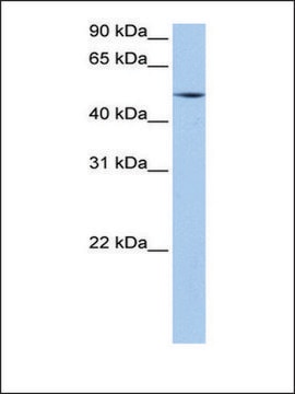 Anti-ESRRG antibody produced in rabbit affinity isolated antibody