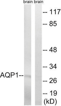 Anti-AQP1 antibody produced in rabbit affinity isolated antibody