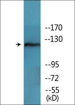 Anti-phospho-FAK (pTyr397) antibody produced in rabbit affinity isolated antibody