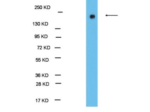 Anti-EHMT1/GLP1 Antibody Upstate&#174;, from rabbit