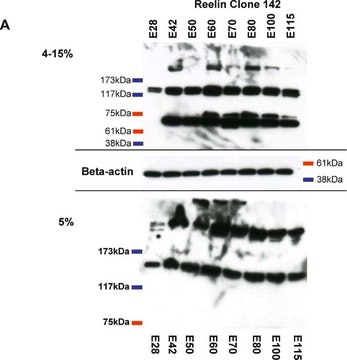 Anti-Reelin Antibody, a.a. 164-189 mreelin, clone 142 clone 142, Chemicon&#174;, from mouse