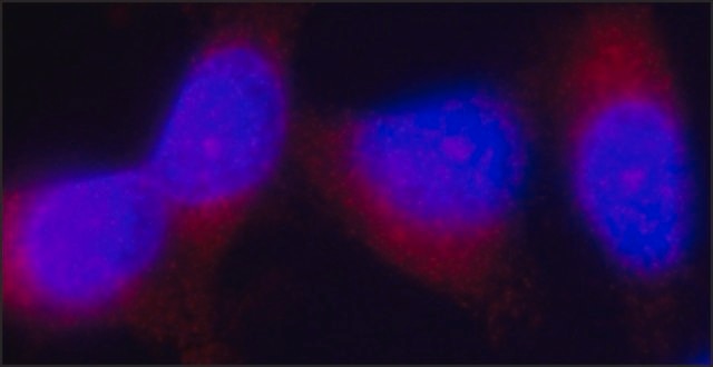 Anti-Tensin 3 antibody, Mouse monoclonal clone TN-17, purified from hybridoma cell culture