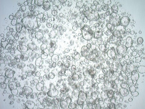 3dGRO Ileum Intestinal Organoids, Age 51 (Prep ht-104-I)