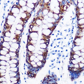 Anti-Monoamine Oxidase A (MAOA) antibody produced in rabbit