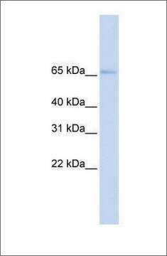 Anti-SLC22A6 (ab2) antibody produced in rabbit affinity isolated antibody