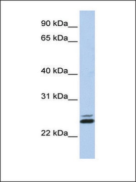 Anti-JAZF1 (AB1) antibody produced in rabbit affinity isolated antibody