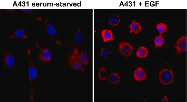 Anti-Phosphotyrosine antibody, Rabbit monoclonal recombinant, expressed in HEK 293 cells, clone RM111, purified immunoglobulin