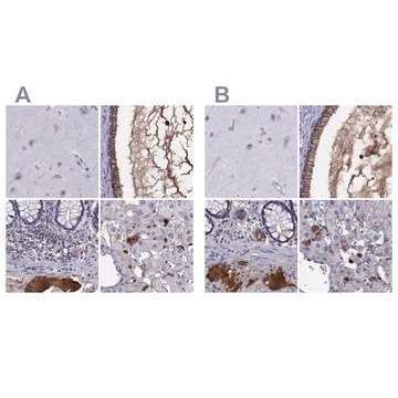 Anti-SERPINA3 antibody produced in rabbit Prestige Antibodies&#174; Powered by Atlas Antibodies, affinity isolated antibody, buffered aqueous glycerol solution