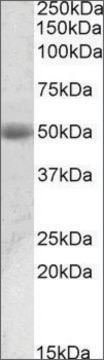 Anti-ACPP antibody produced in goat affinity isolated antibody, buffered aqueous solution