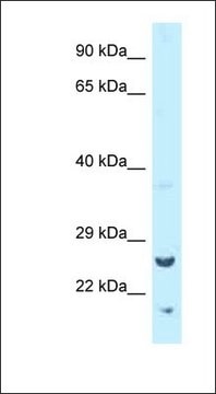 Anti-TK1 antibody produced in rabbit affinity isolated antibody