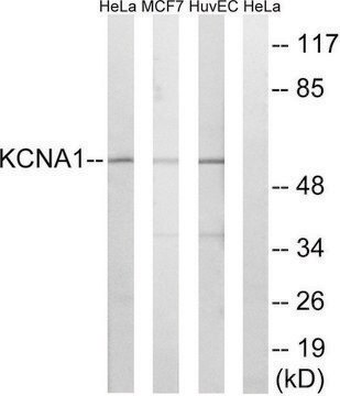 Anti-KCNA1 antibody produced in rabbit affinity isolated antibody