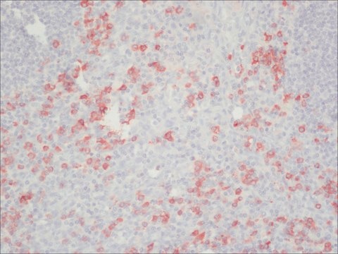 Anti-Human IgG (Fc specific)&#8722;Peroxidase antibody produced in goat affinity isolated antibody