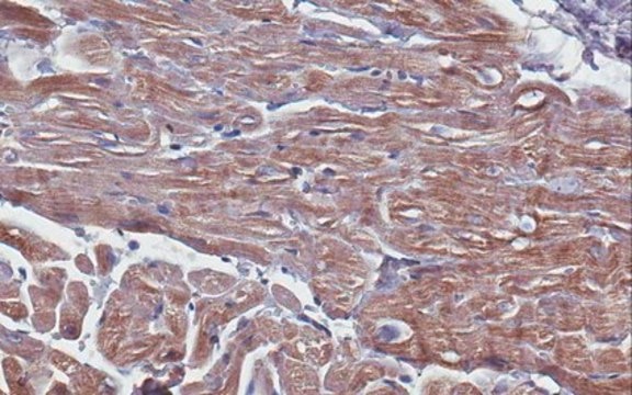 Anti-Troponin T (Cardiac Muscle) Antibody, clone 9C2.1 clone 9C2.1, from mouse