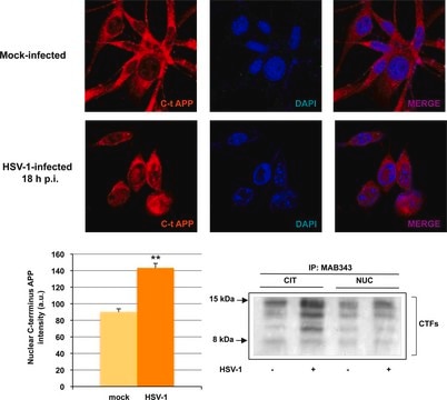 Anti-APP Antibody, APP 643-695 CT fragment, clone 2.F2.19B4 ascites fluid, clone 2.F2.19B4, Chemicon&#174;