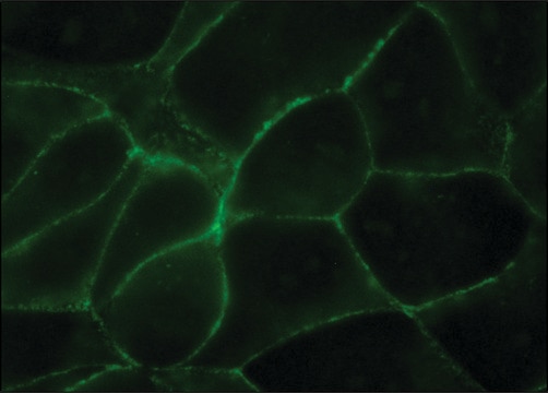 Monoclonal Anti-Uvomorulin/E-Cadherin antibody produced in rat clone DECMA-1, purified from hybridoma cell culture