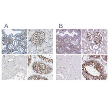 Anti-AKAP12 antibody produced in rabbit Prestige Antibodies&#174; Powered by Atlas Antibodies, affinity isolated antibody, buffered aqueous glycerol solution