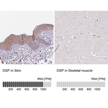 Anti-DSP antibody produced in rabbit Prestige Antibodies&#174; Powered by Atlas Antibodies, affinity isolated antibody, buffered aqueous glycerol solution