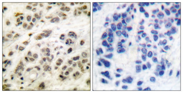 Anti-MYC antibody produced in rabbit affinity isolated antibody