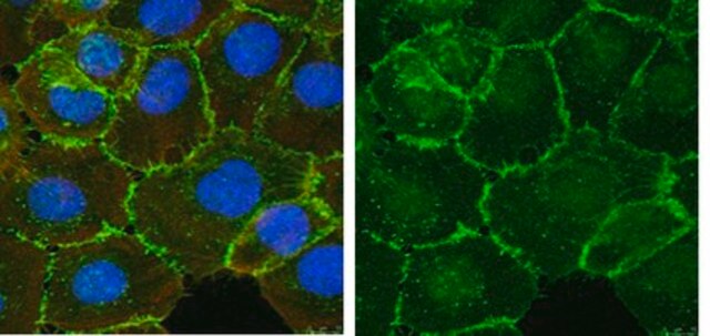 Anti-&#946;-Catenin Antibody Upstate&#174;, from rabbit