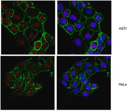 Anti-Histone H2B Antibody, clone 5HH2-2A8 ascites fluid, clone 5HH2-2A8, from mouse