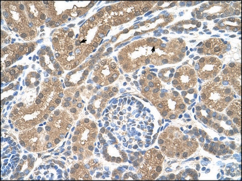 Anti-SLC16A8 antibody produced in rabbit IgG fraction of antiserum