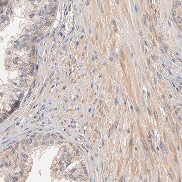 Anti-PDE5A antibody produced in rabbit Ab1, Prestige Antibodies&#174; Powered by Atlas Antibodies, affinity isolated antibody, buffered aqueous glycerol solution