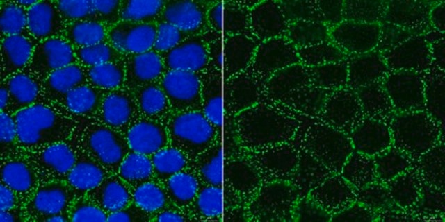 Anti-Desmoglein 2 Antibody, clone 6D8 clone 6D8, from mouse