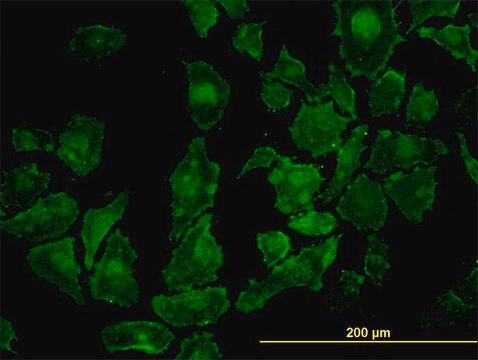 Monoclonal Anti-ROCK1 antibody produced in mouse clone 2E2, purified immunoglobulin, buffered aqueous solution