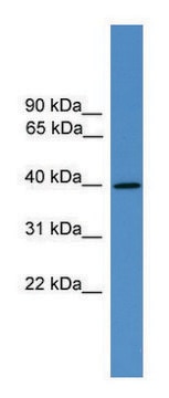 Anti-AVPR2 (C-terminal) antibody produced in rabbit affinity isolated antibody