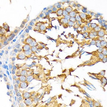 Anti-ALDH1A2 antibody produced in rabbit