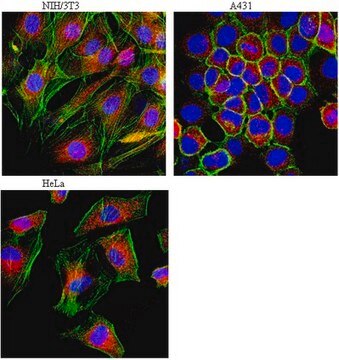 Anti-LAMP-1 (CD107a) Antibody from rabbit, purified by affinity chromatography