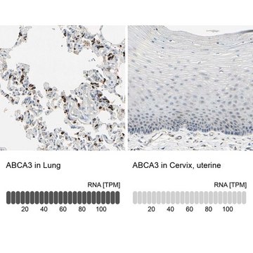 Anti-ABCA3 antibody produced in rabbit Prestige Antibodies&#174; Powered by Atlas Antibodies, affinity isolated antibody, buffered aqueous glycerol solution