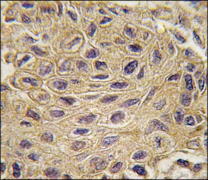 Anti-CTGF (center) antibody produced in rabbit saturated ammonium sulfate (SAS) precipitated, buffered aqueous solution