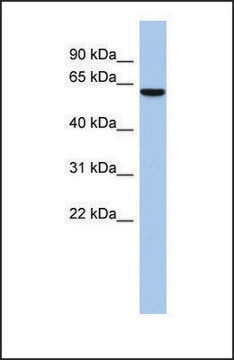 Anti-LEMD2 antibody produced in rabbit affinity isolated antibody