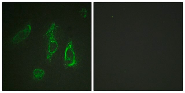 Anti-EPO-R antibody produced in rabbit affinity isolated antibody