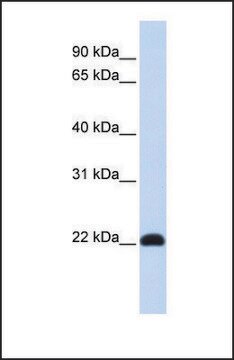 Anti-KLF16, (N-terminal) antibody produced in rabbit affinity isolated antibody