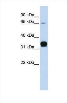 Anti-TNNT1 antibody produced in rabbit affinity isolated antibody